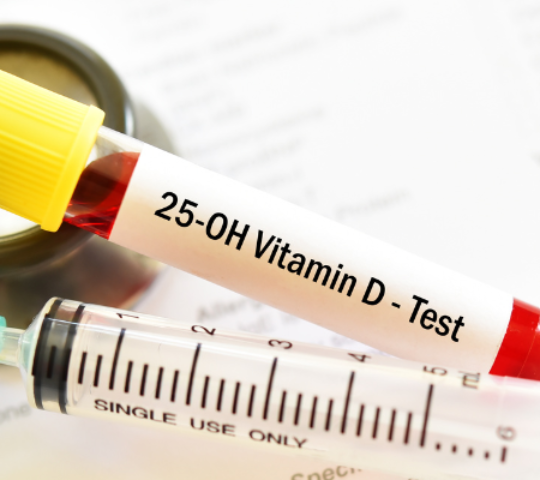 Exame de Vitamina D-25 Hidroxi
