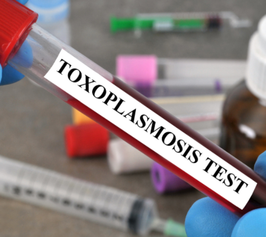Toxoplasmose