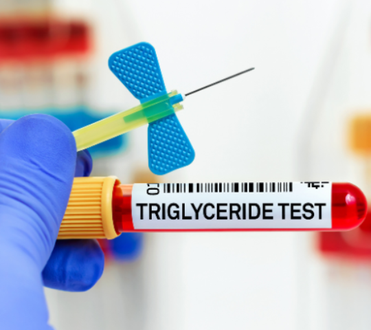 Triglicerídeos